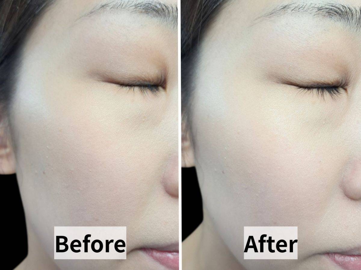 REVLON(レブロン) スキンライト プレスト パウダー R 001 ピンク オパールの仕上がりビフォーアフター比較画像