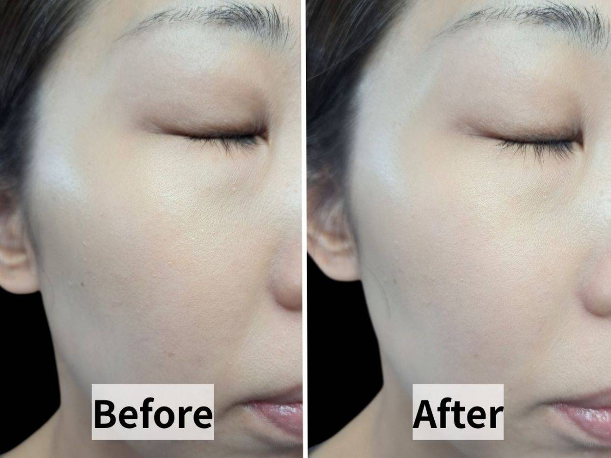 REVLON(レブロン) スキンライト プレスト パウダー R 002 シャンパン ベージュ の仕上がりビフォーアフター比較画像