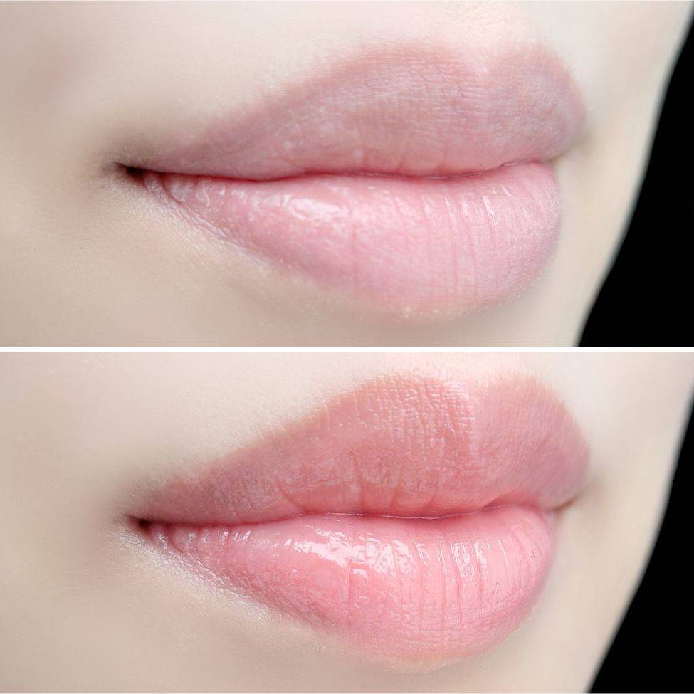 リップケア #deco# EiZgZxqsWBGgYuDcVseJuv9VKBBzDn
