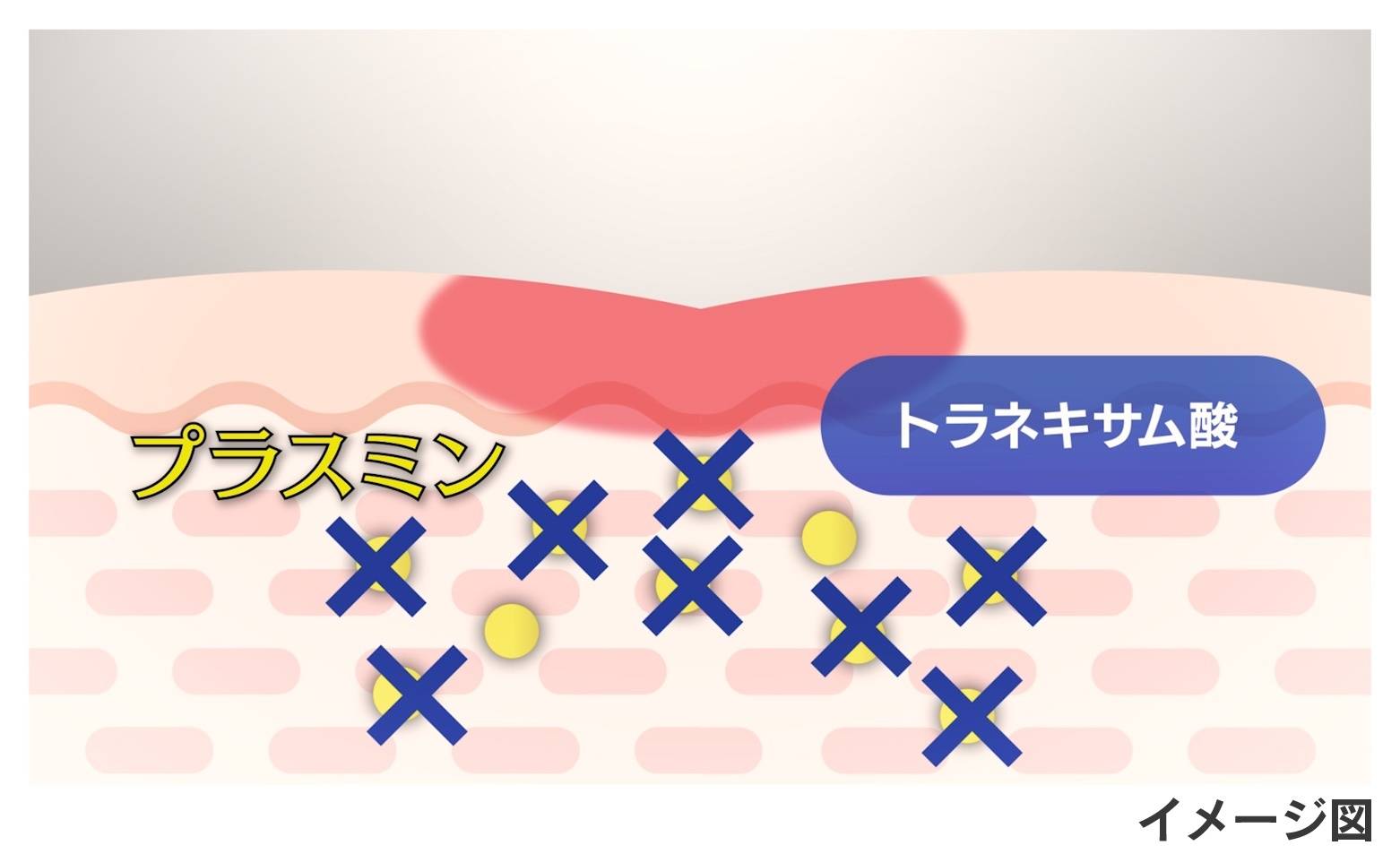 プラスミンとトラネキサム酸のイメージ図