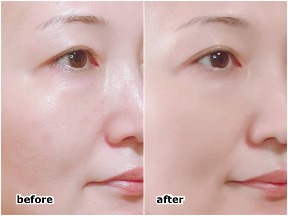 SUQQU スック スムースカバープライマー UV化粧下地 塗布前 塗布後 before after 筆者顔