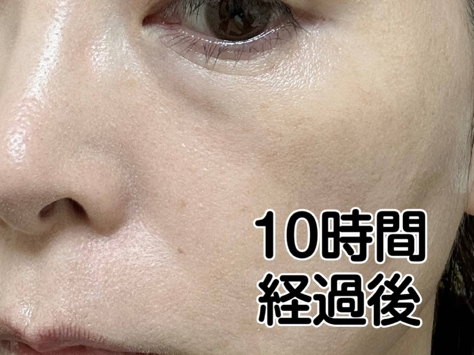 メイクキープパウダー塗布後１０時間の顔の画像