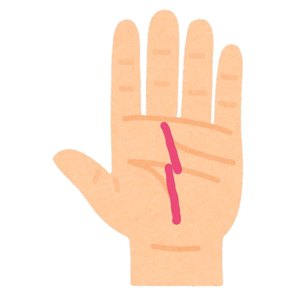 途切れている運命線