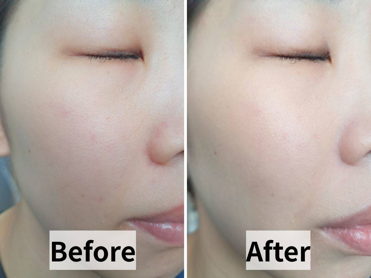 Elégance(エレガンス) グロウリフティング ベース　BE900のビフォーアフター比較画像