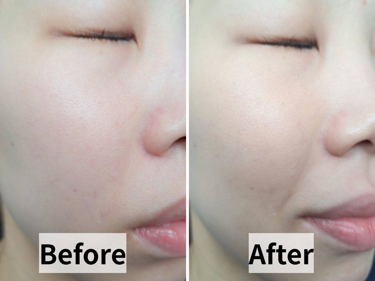 クレ・ド・ポー ボーテ タンクッションエクラ ナチュレルのビフォーアフター比較画像