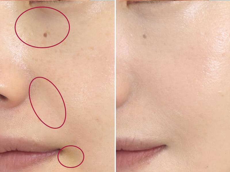 Viseeカラーデュオトリックコンシーラーを塗る前と塗った後の比較