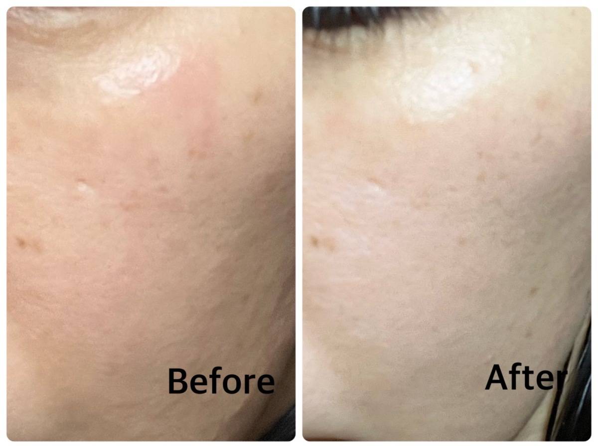 美容液使用前、使用後