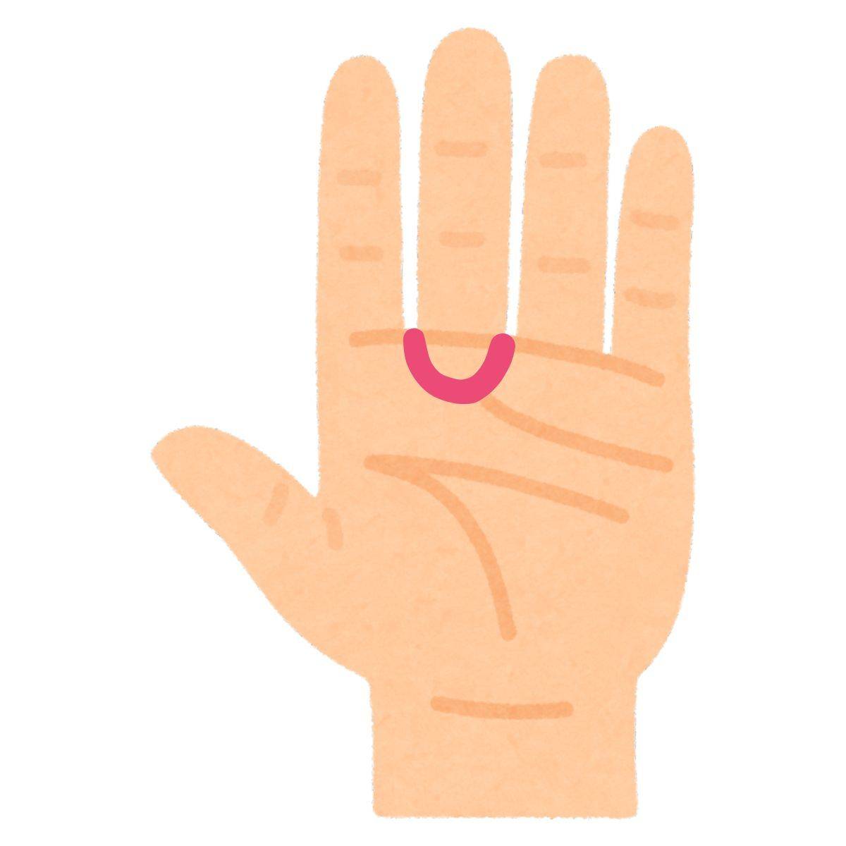 アブノーマル線