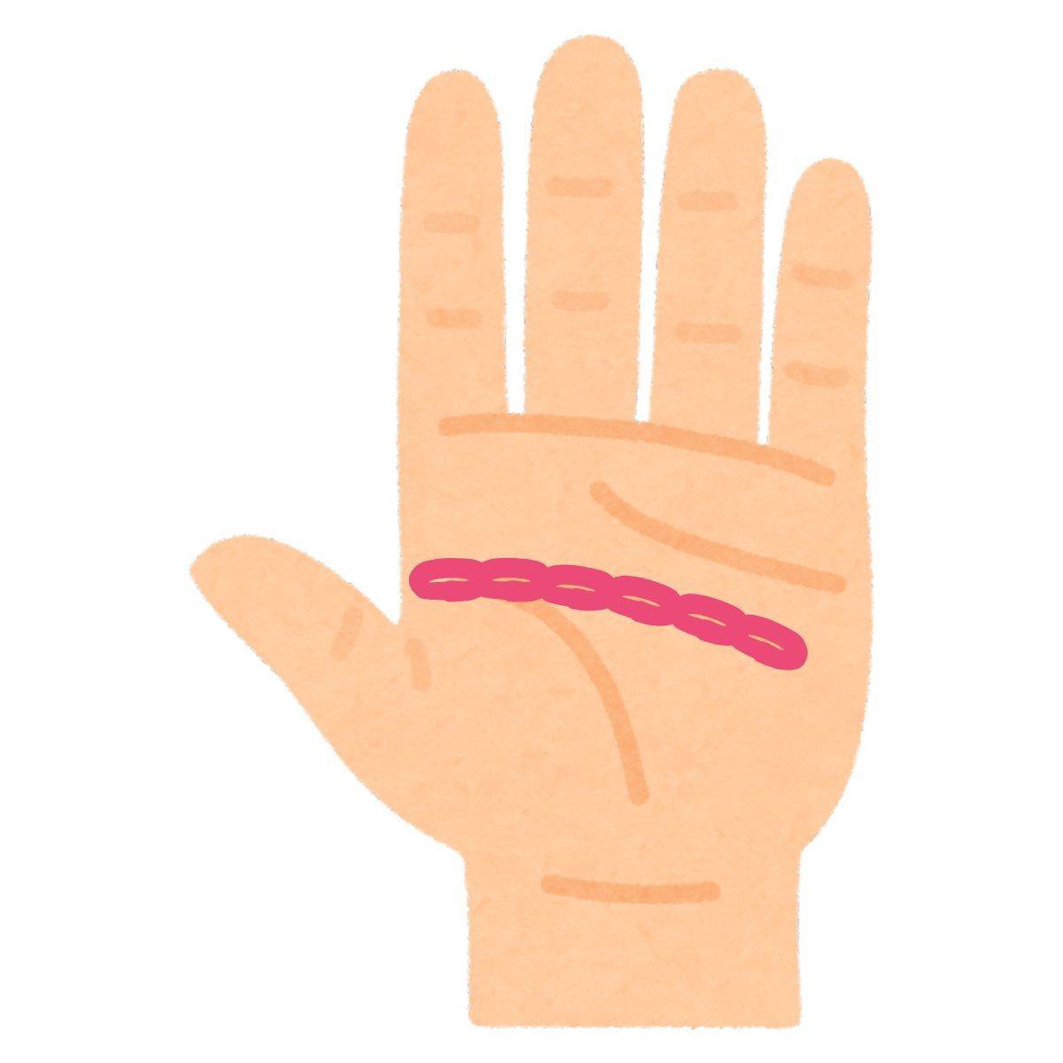 鎖状になっている知能線