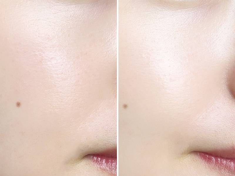 ポアレスキーパードライの塗り前後比較(顔)