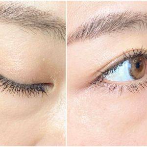  KiSS メロウシャドウ 