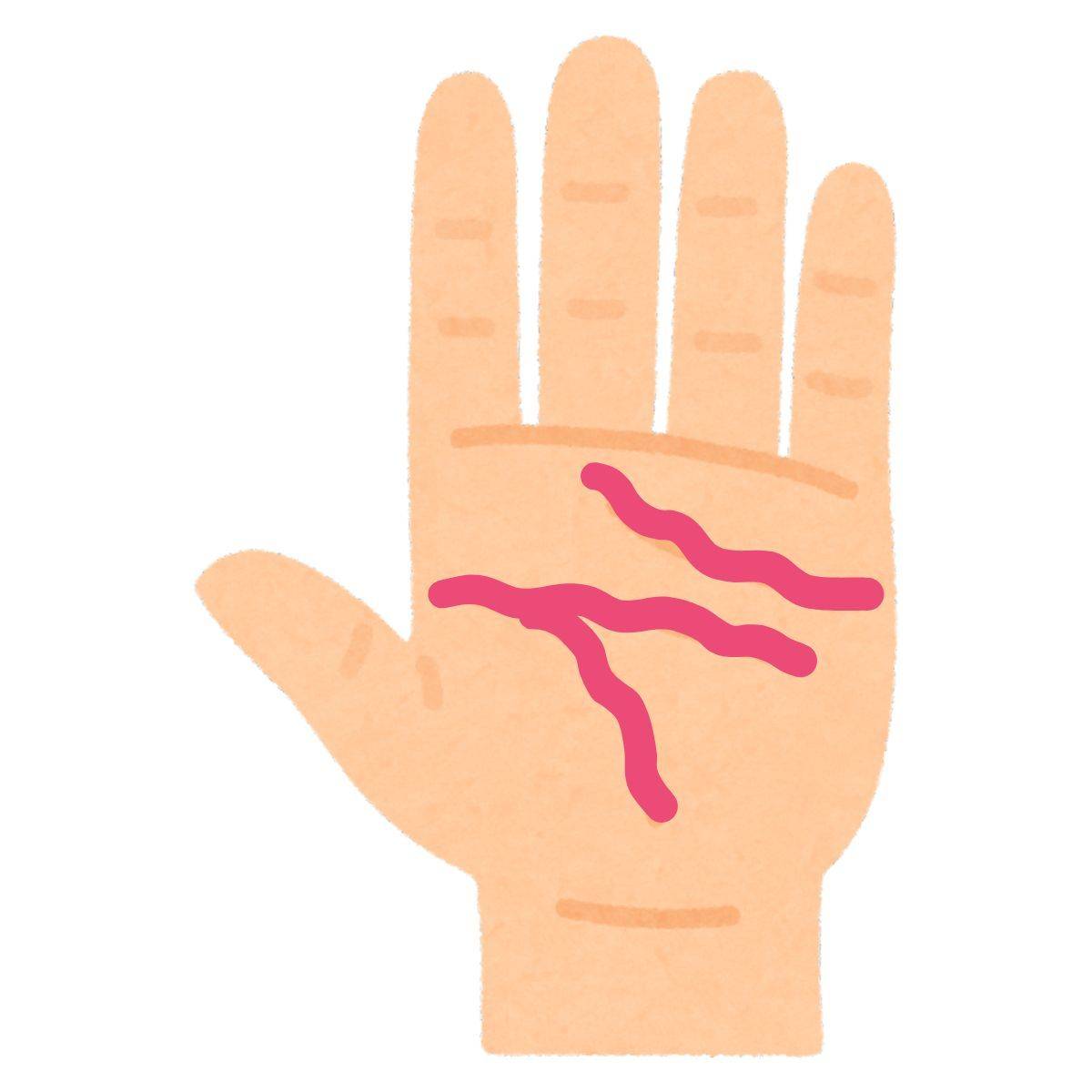 波打っている線が多い