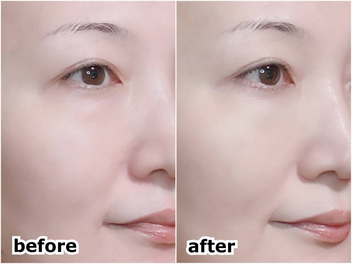 nake ネイク カバーエイドコンシーラー 01 ニュートラルベージュ マツキヨ before after 筆者顔