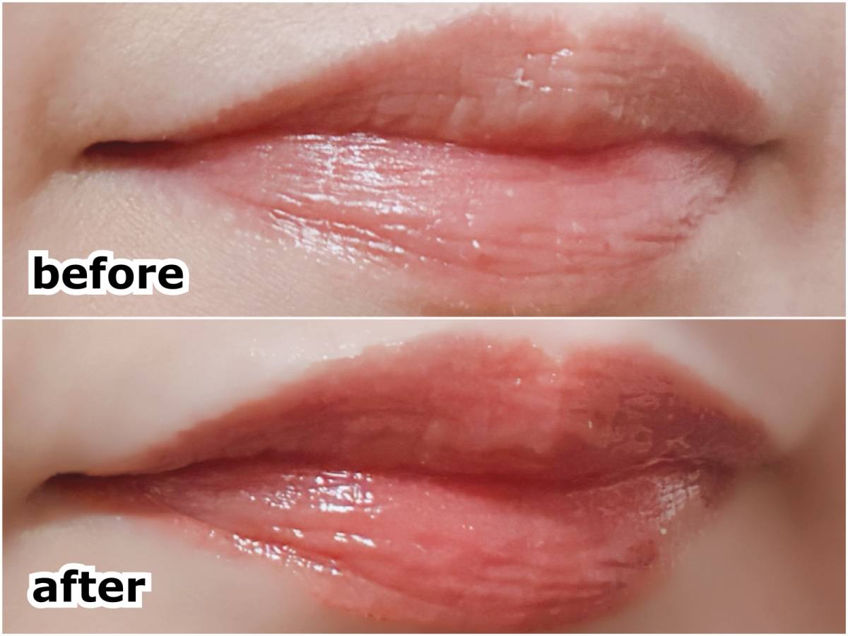 ザ・レチノタイム リンクルリップエッセンス プランパー シアーレッド マツキヨ 塗布前 塗布後 before after 筆者唇