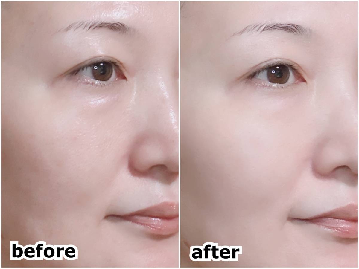 ザ・レチノタイム リンクルデイミルクUV マツキヨ 塗布後 筆者顔 before after