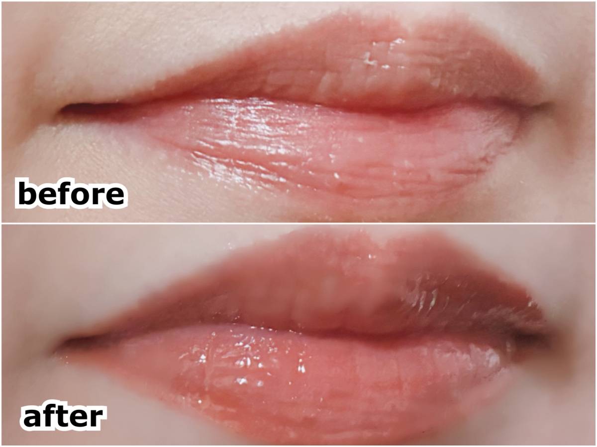 ザ・レチノタイム リンクルリップエッセンス プランパー レッドブラウン マツキヨ 塗布前 塗布後 before after 筆者口元