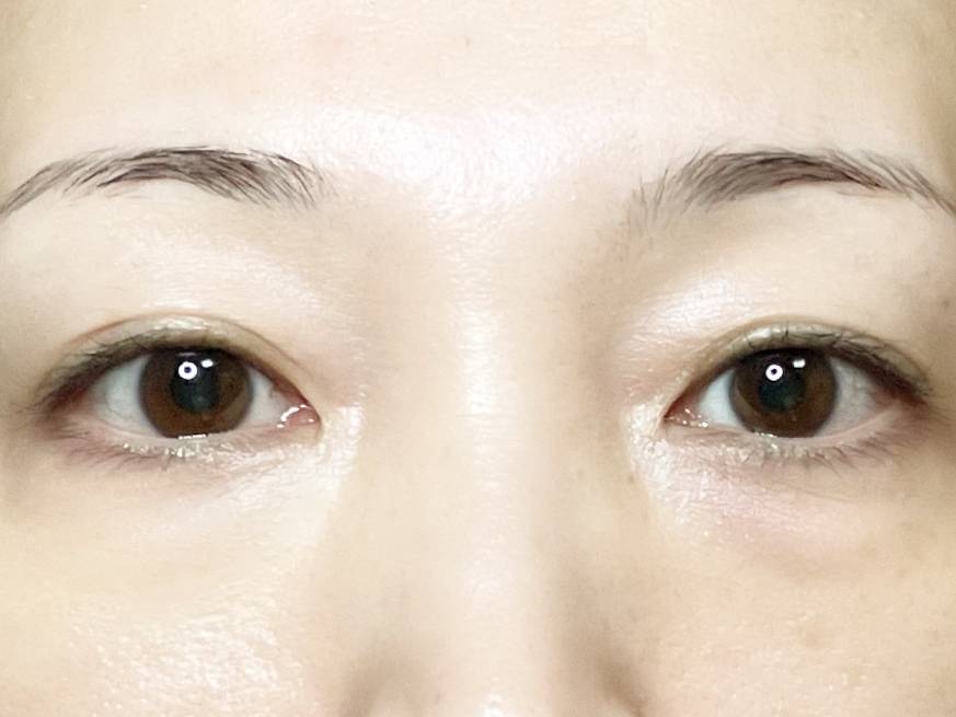 POLA BA 3D コンシーラー 01 ブライトアップベージュ 02 カバリンクオレンジ 筆者顔 クマ部分 before after