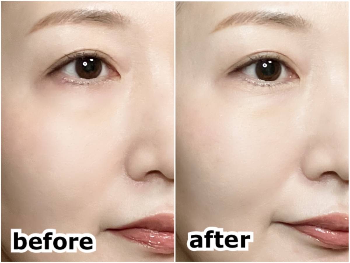 涙袋メイクのbefore after