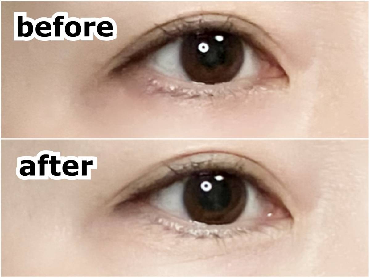 目元アップのbefore after