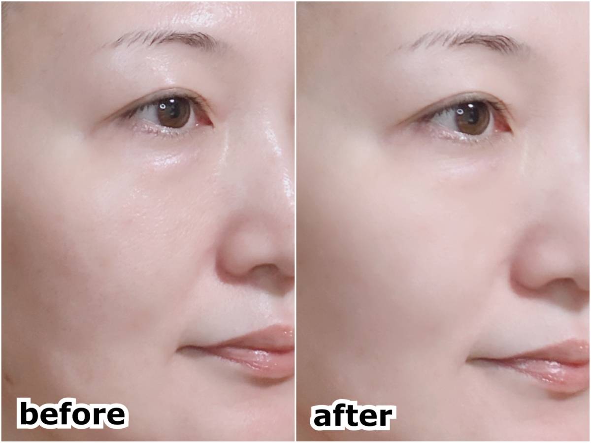 tfit ティーフィット デリケートシルクヴェールアートプライマー 化粧下地 塗布前 塗布後 筆者顔 before after