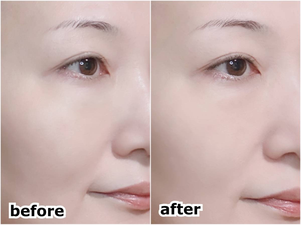 vim BEAUTY ヴィム ビューティー キープコンフィデンスパウダー フェイスパウダー 塗布前 塗布後 before after 筆者顔