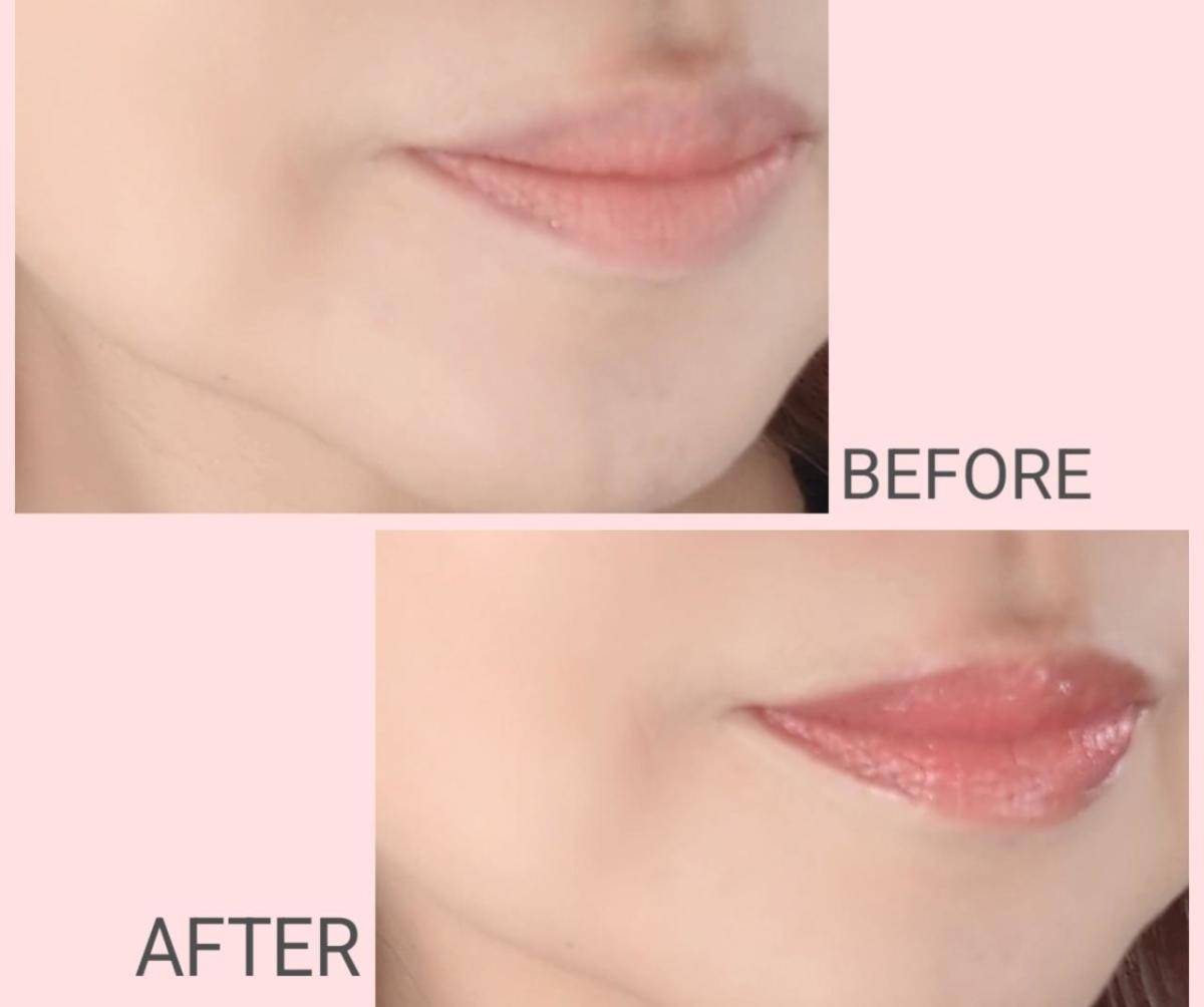 リンメルカムアップローズビフォーアフター画像