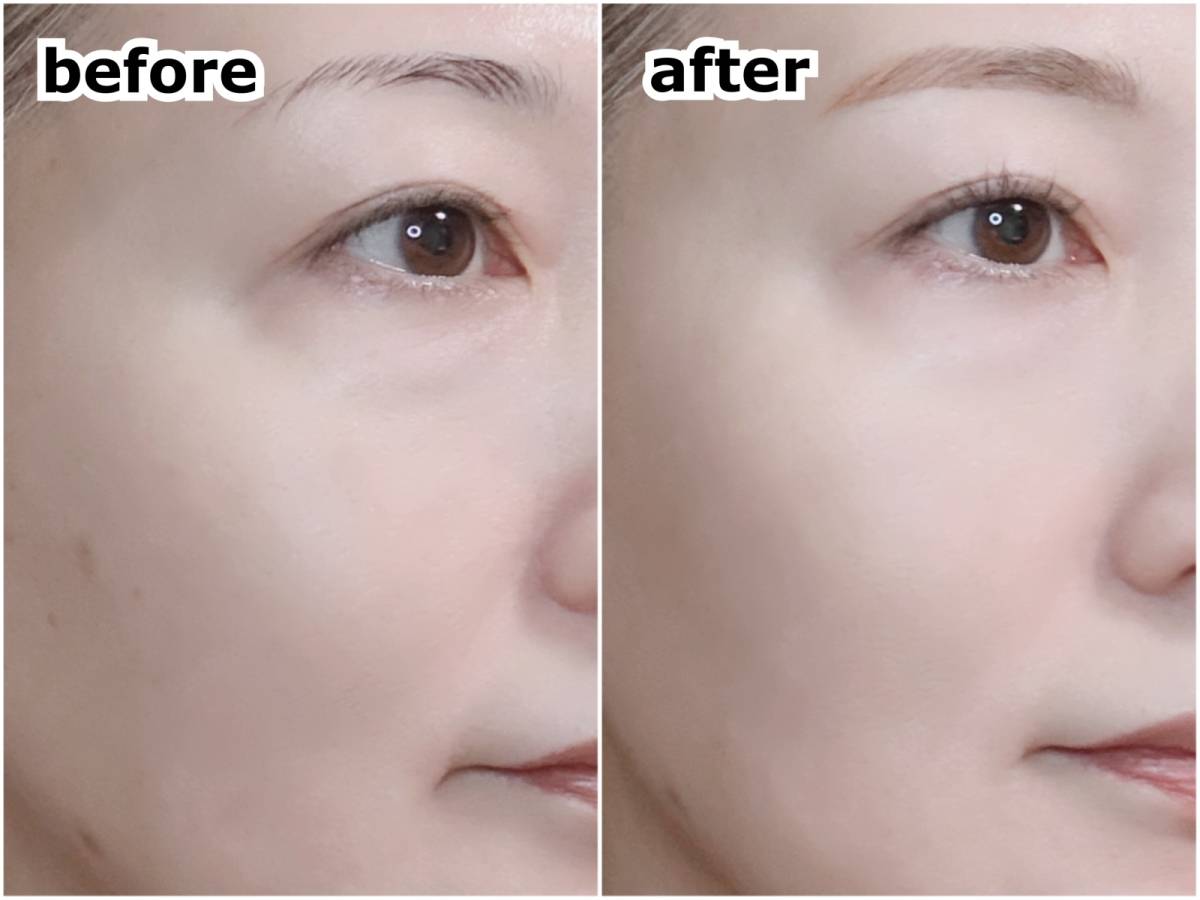 matsukiyo muice マツキヨ ミュアイス スポットメンテパウダー MC01 トトノエベージュ 塗布前 塗布後 before after 筆者顔