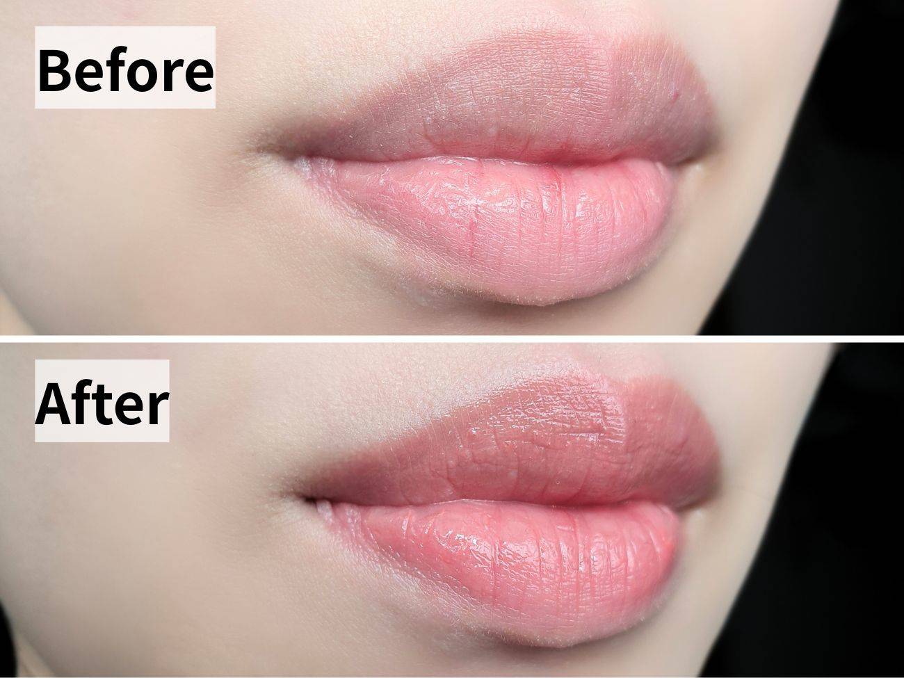 リリミュウ バタールージュ 07 ピーチクラシックのビフォーアフター比較画像