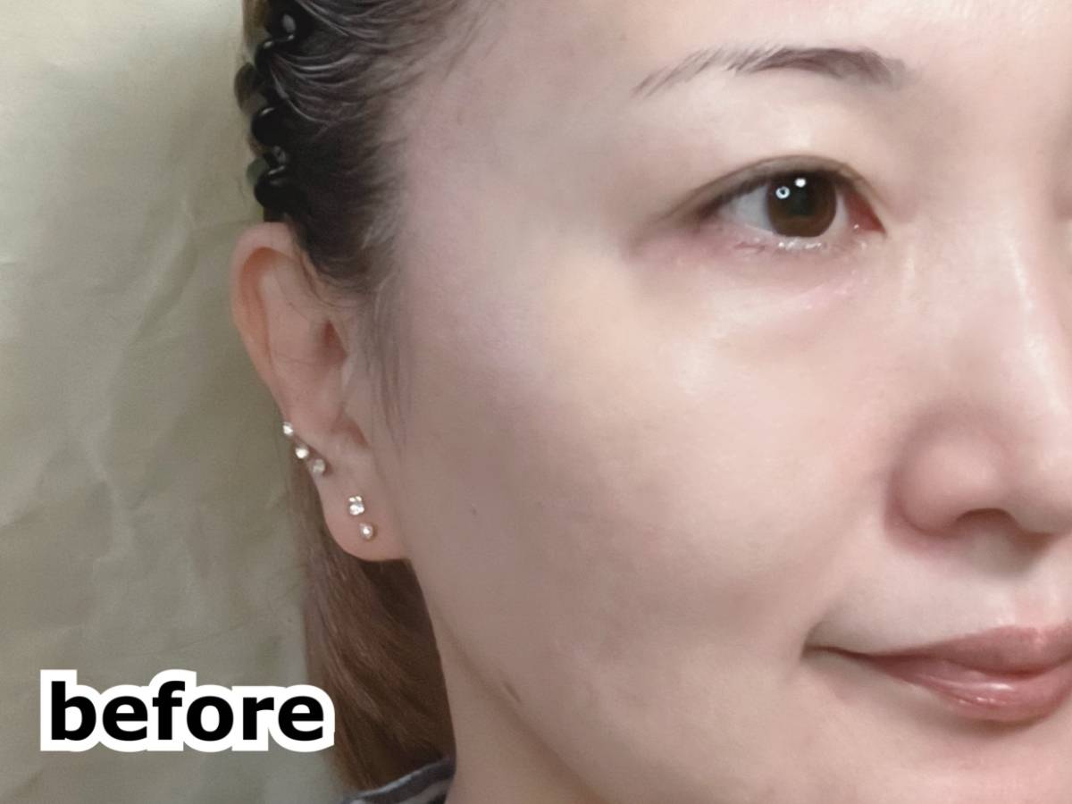 ORBIS U オルビスユー カラースキンケアマスクファンデーション ナチュラル01 リキッドファンデーション 顔に塗布 筆者顔 before