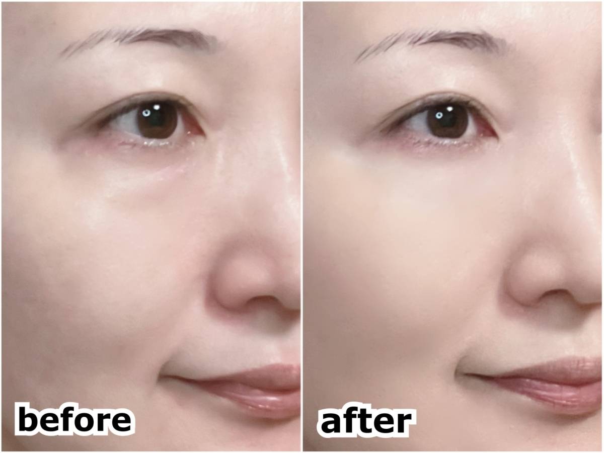 ORBIS U オルビスユー カラースキンケアマスクファンデーション ナチュラル01 リキッドファンデーション 顔に塗布 before after 筆者顔