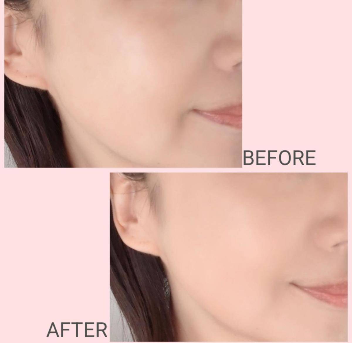 ファンデーション塗布ビフォーアフター画像