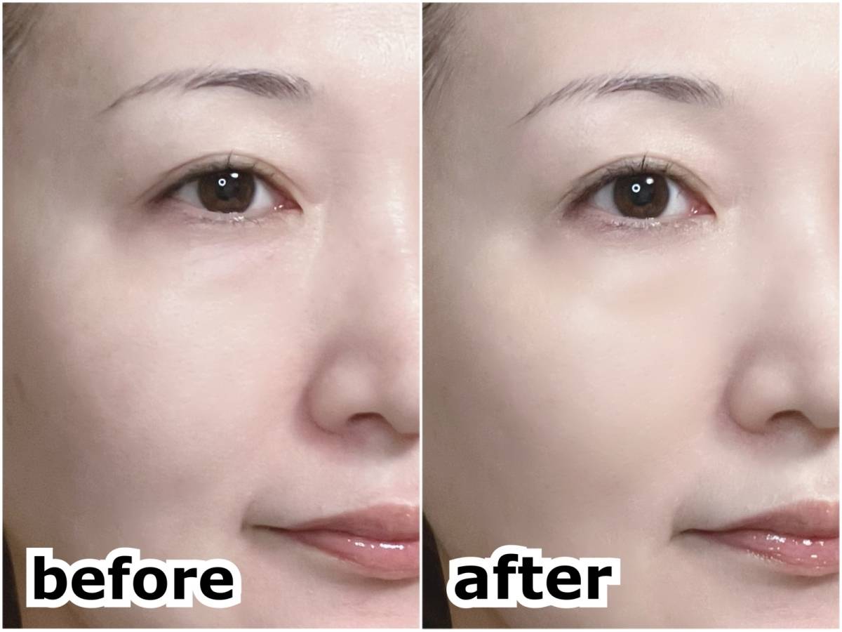 media メディア クリームファンデーションN PO-B1 コンビニ限定ミニサイズ 筆者顔 塗布 下地後 ファンデ後 before after