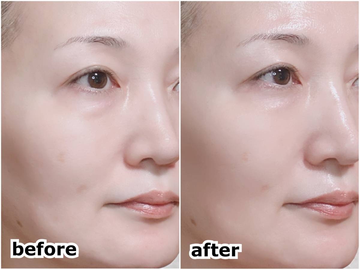 MISSHA ミシャ グロウスキンバーム 朝クリーム兼化粧下地 筆者顔 すっぴん 塗布前 下地塗布後 before after