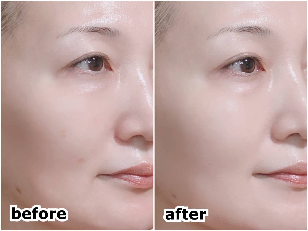 MISSHA ミシャ グロウクッションファンデーション ルミナスカバー No.21 ライト 塗布前 塗布後 筆者顔 before after