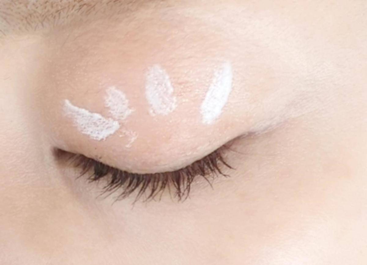 上まぶたの補正