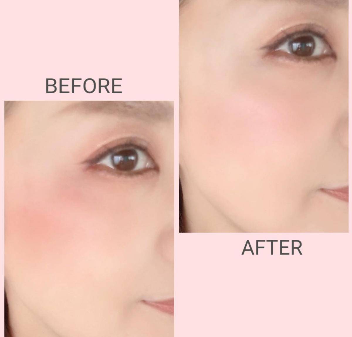 のせすぎチークの緩和ビフォーアフター画像