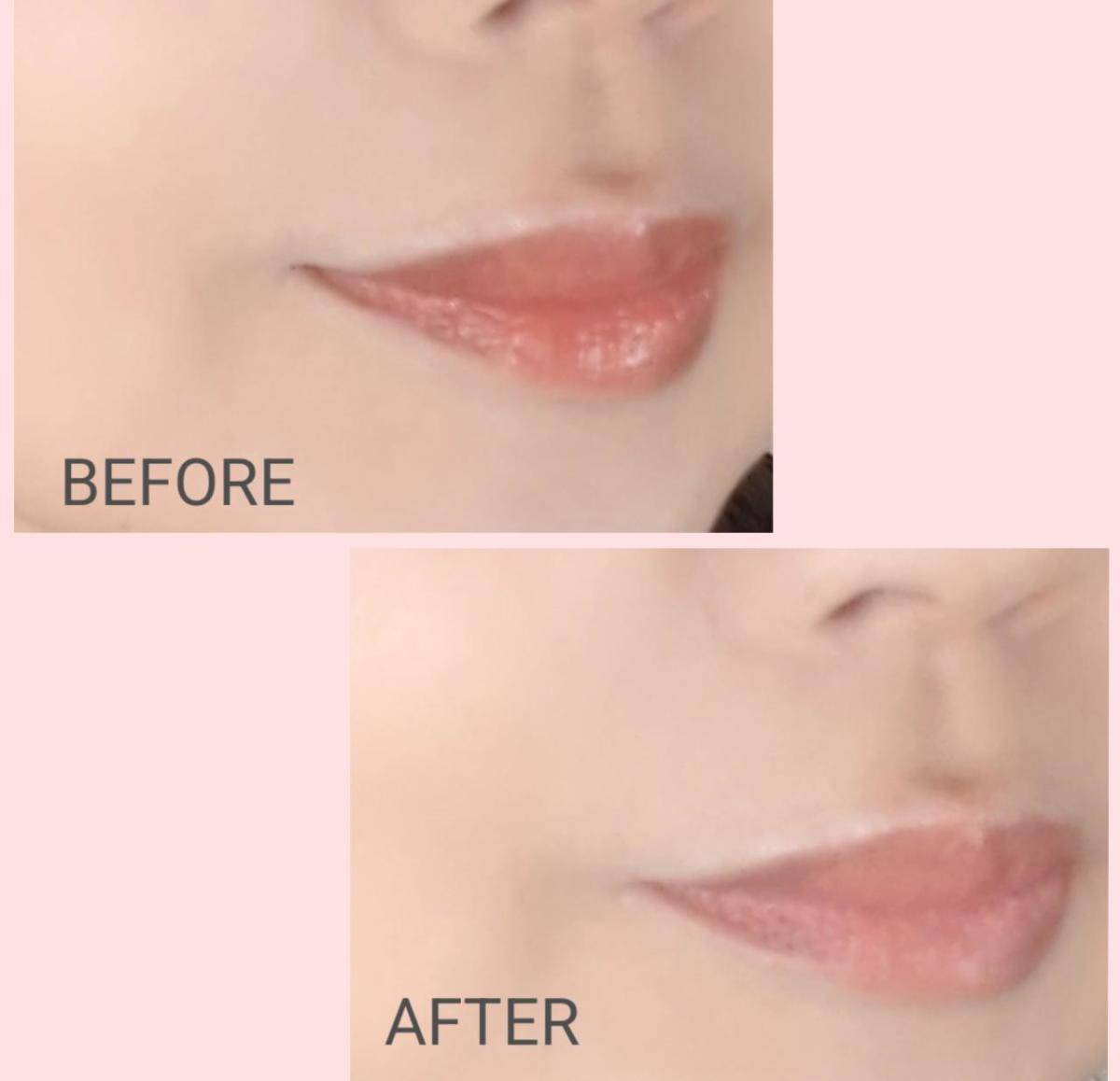 のせすぎリップを緩和したビフォーアフター画像