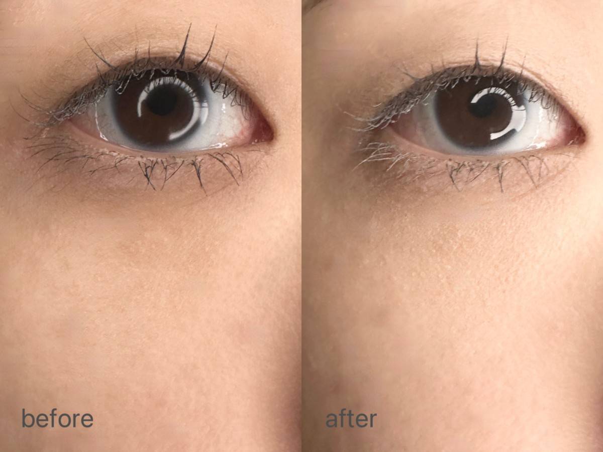 Wonjungyo　カバーマスターブライトニングコンシーラーを使用したビフォーアフター