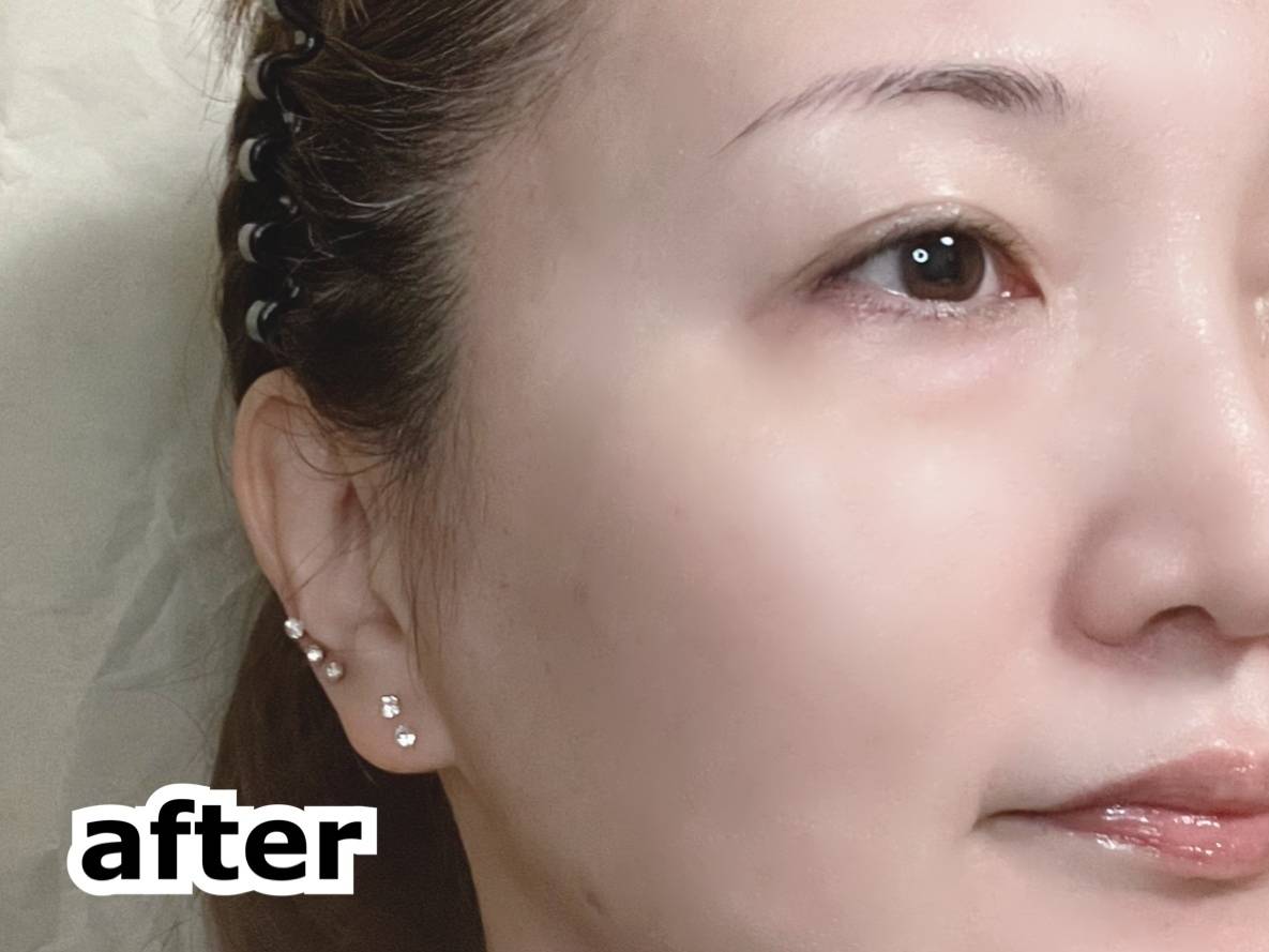 NARIS UP ナリスアップ ワンリスト オールインワン デイクリーム LB ラベンダーベージュ 顔に塗布 after 筆者顔