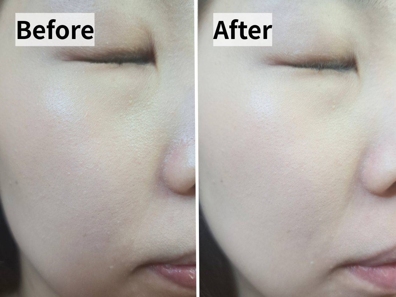 Elégance(エレガンス) ラ プードル オートニュアンス II の仕上がりビフォーアフター比較画像