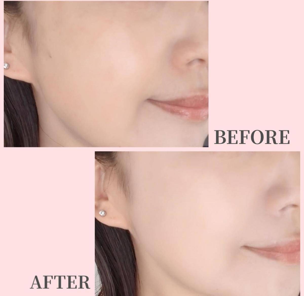 ヴィセトーンアップスキンデザイナービフォーアフター画像