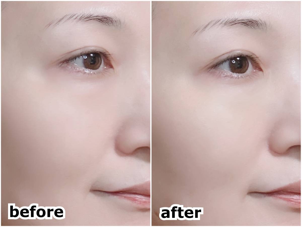 &nd by rom&nd アンドバイロムアンド Greige グレージュ シリーズ メロウカバーコンシーラー BE01ピュア 塗布前 塗布後 before after 筆者顔