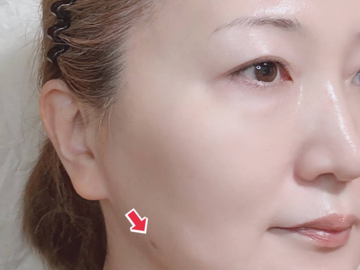 &nd by rom&nd アンドバイロムアンド Greige グレージュシリーズ メロウカバーコンシーラー BE02ナチュラル シミの場所 筆者顔