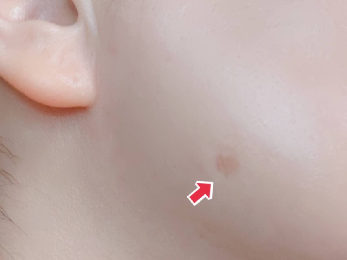 &nd by rom&nd アンドバイロムアンド Greige グレージュシリーズ メロウカバーコンシーラー BE02ナチュラル シミを下から見たところ 筆者顔