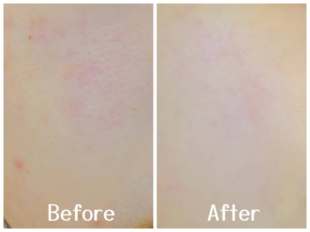 顔に塗ったbefore after