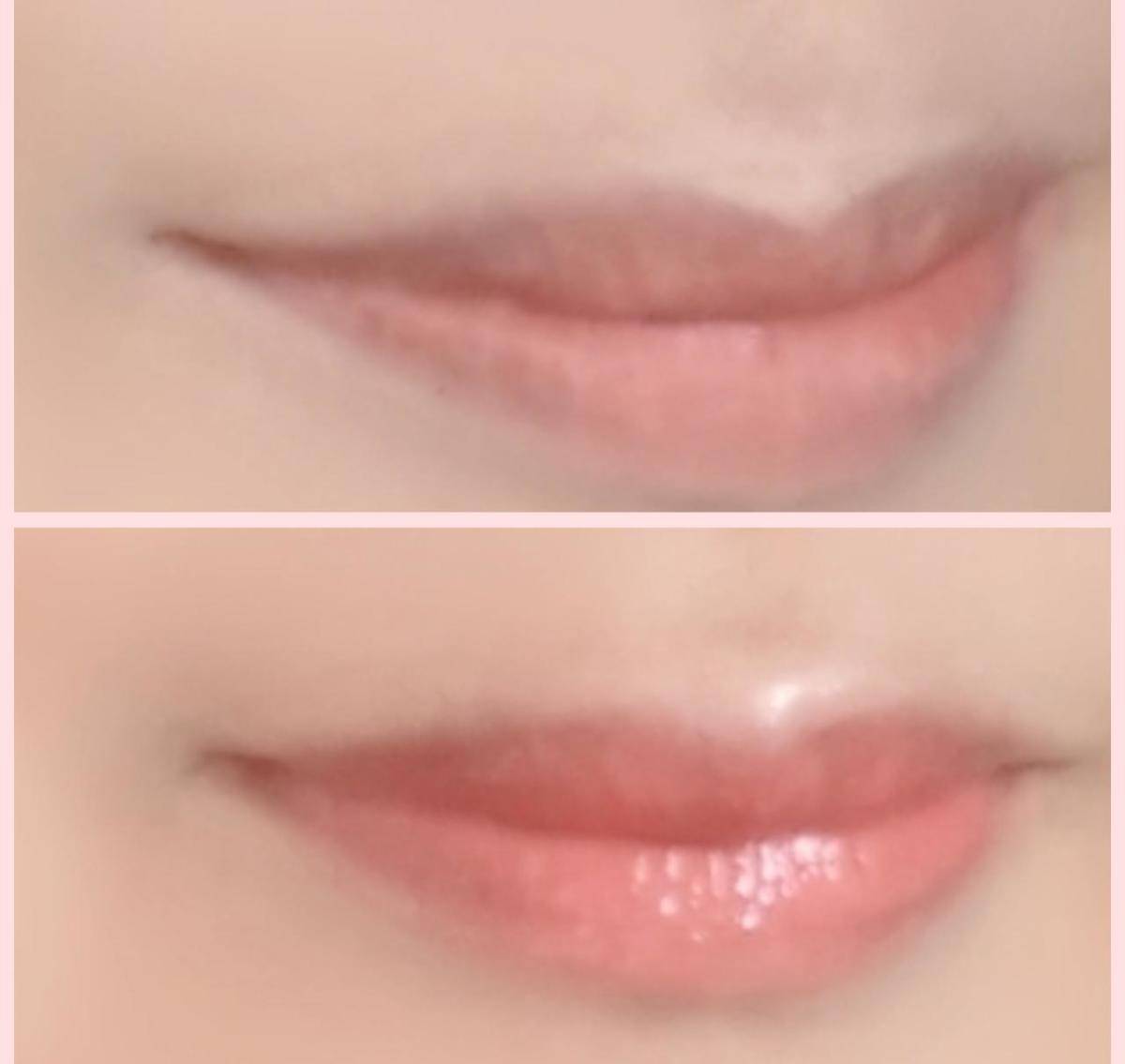 メンソレータムリップフォンデュロゼピンクビフォーアフター画像