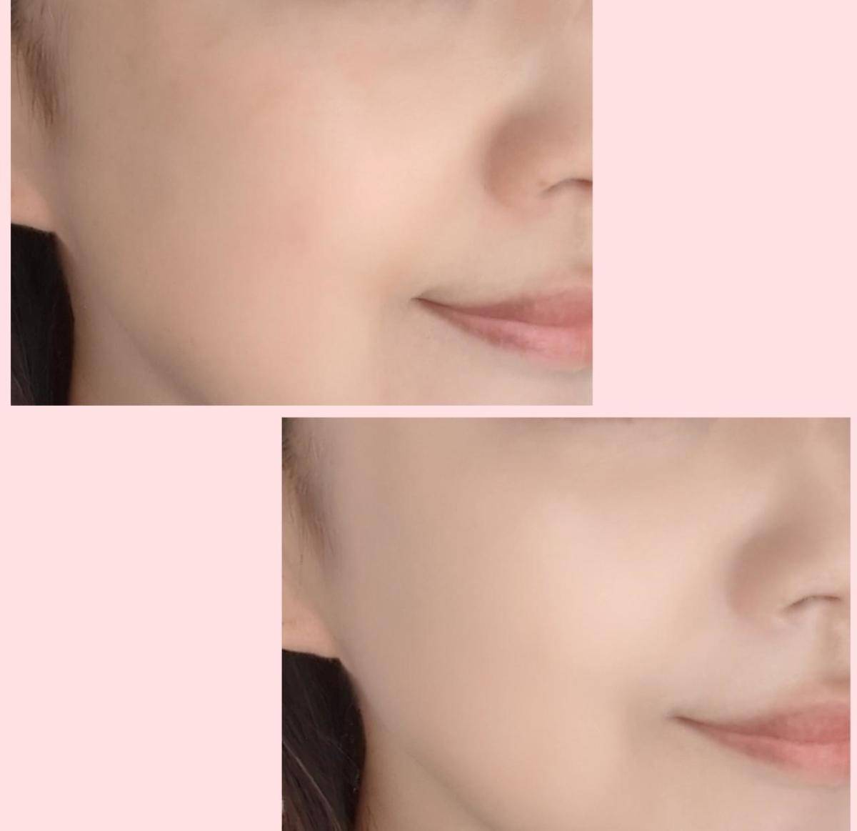 エレガンスグロウリフティングベースUVBE991ビフォーアフター画像