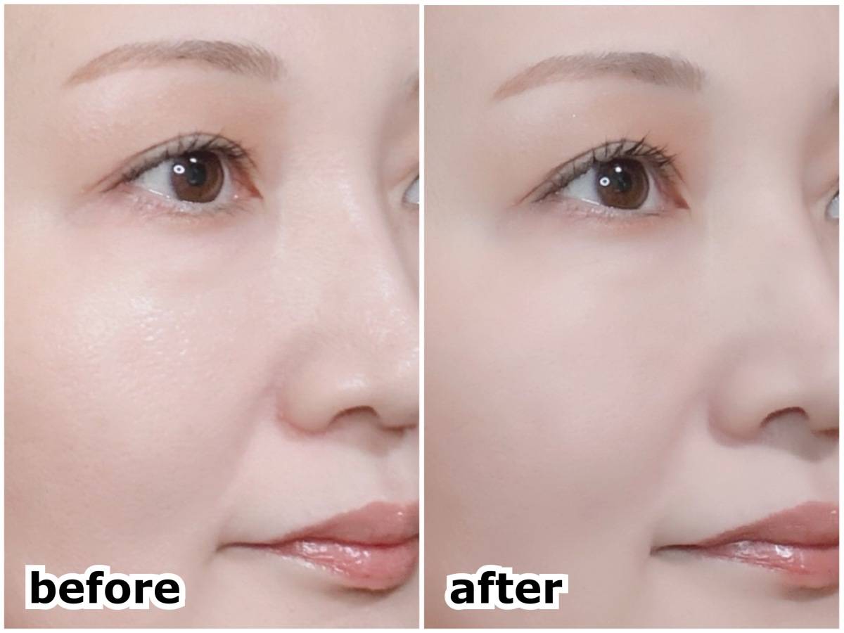 Fujiko フジコ あぶらとりウォーターパウダーNEO メイク直し クッション 塗布前 塗布後 before after 筆者顔